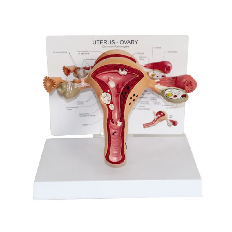 pathological model of ovarian uterus reproductive medicine gifts ...