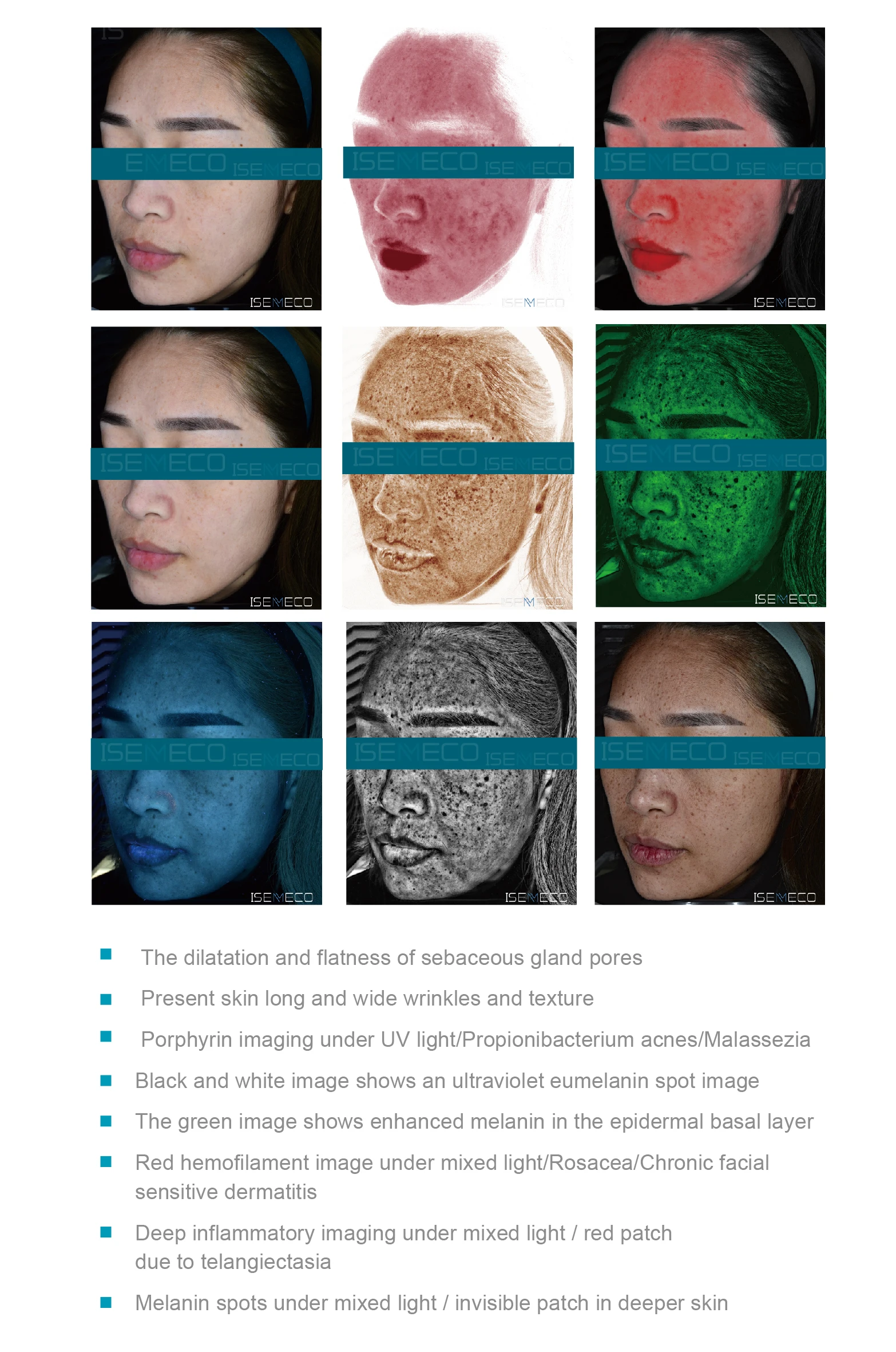 Isemeco S7 Face Skin Analyzer Advanced Home Facial Scanner