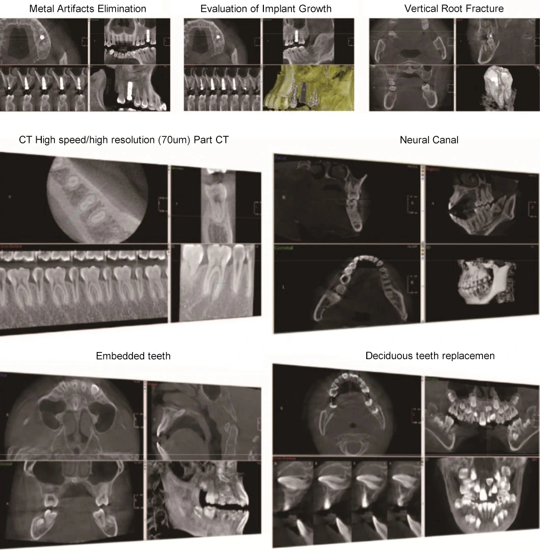 High Quality Digital Radiography 3D CBCT Panoramic Dental X-ray Machine, Teeth Xray Scanner manufacture