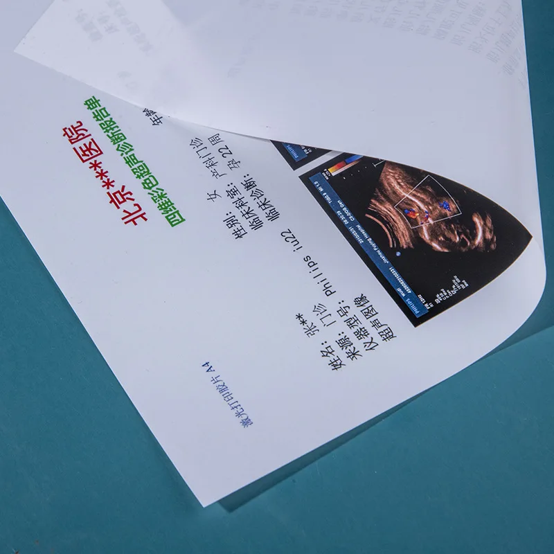 Inkjet Blue Medical Dry Film Transparent Blue Xray Film For CT DR MRI Radiological Device