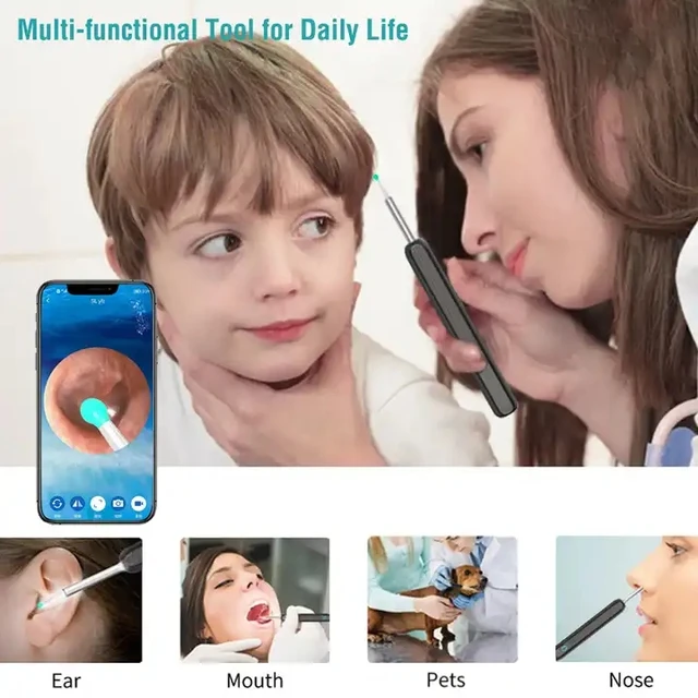 Wifi Visual Ear Spoon Mini 1080p Hd Camera 3.5mm 5mp Electric Ear Wax Removal Cleaner - Image 6