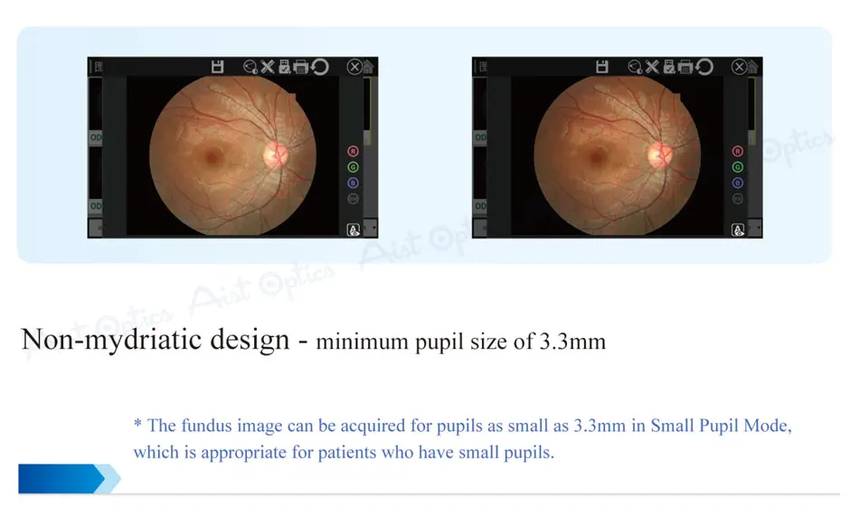 Reticam-3100 Ophthalmic Non-mydriatic Automatic Digital Retinal Fundus Camera