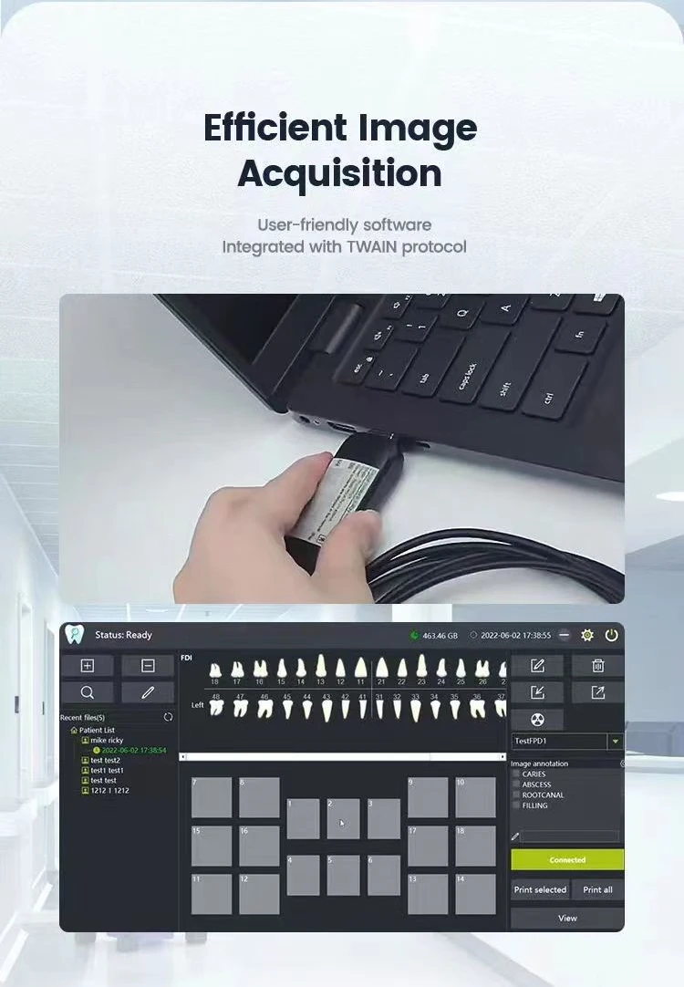 Iray Factory Made High Quality Dental Digital Rvg Intraoral Xray