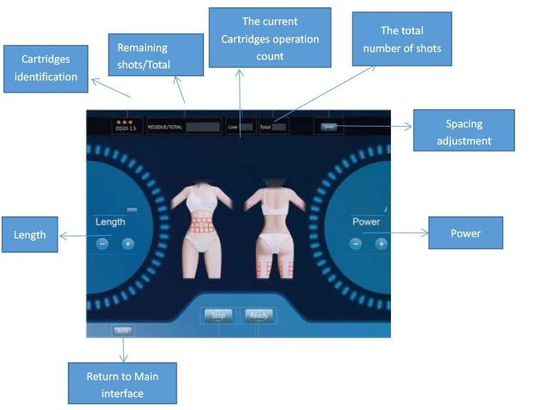 Portable 3D Anti-wrinkle Skin Tightening Ultrasound Face Lift Machine
