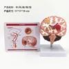 Modèle cérébral pathologique