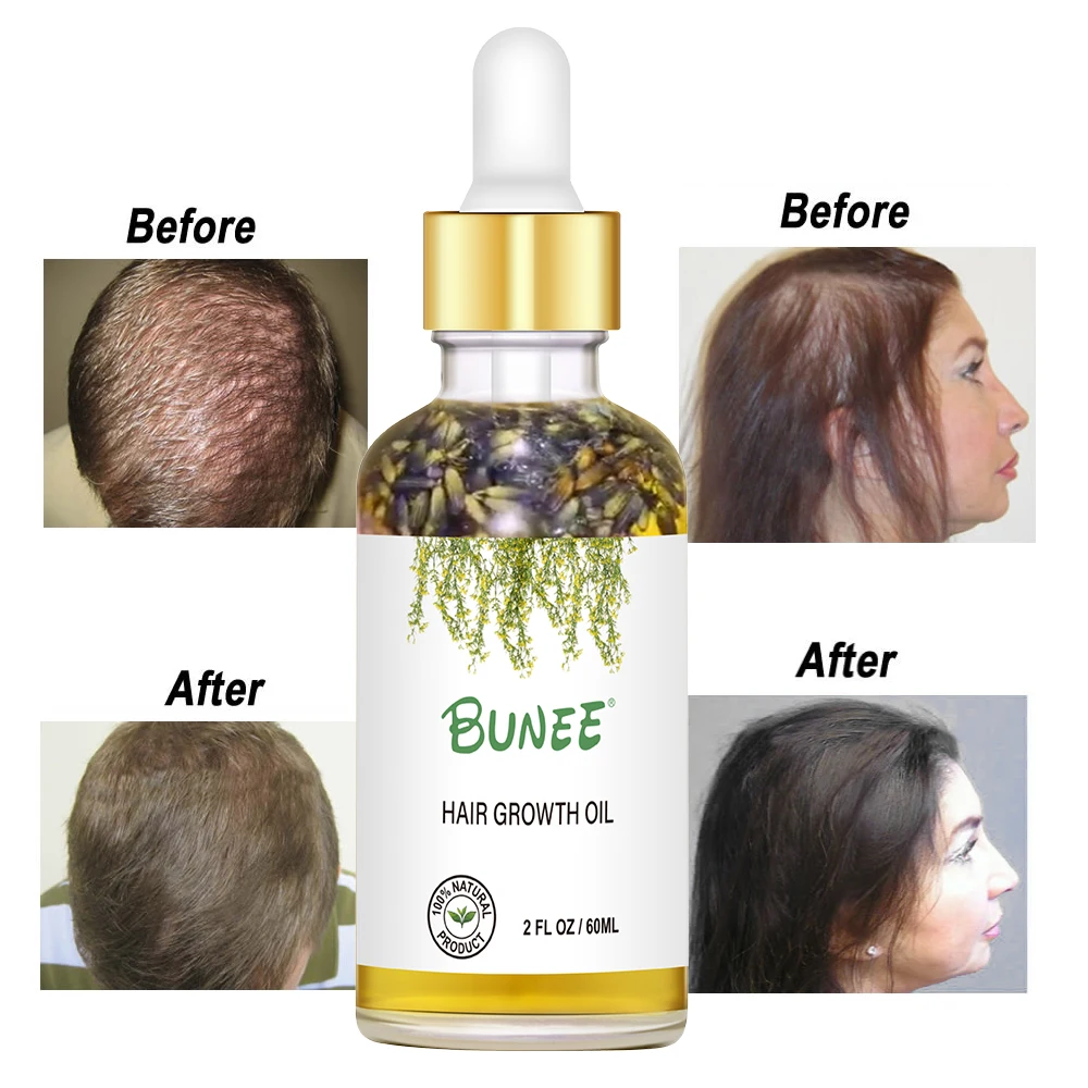 Bunee 60ml Custom Label Organic Lavender Seed Rosemary Oil Hair Growth
