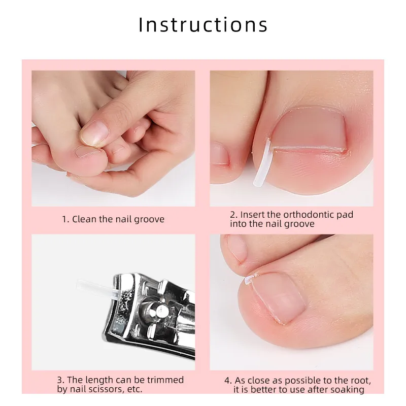 Ingrown Toenail Tool Ingrown Toenail Corrector Pad 10 Pcs Straightener Clip Pedicure Tools Toe Nail Care Protects Toe