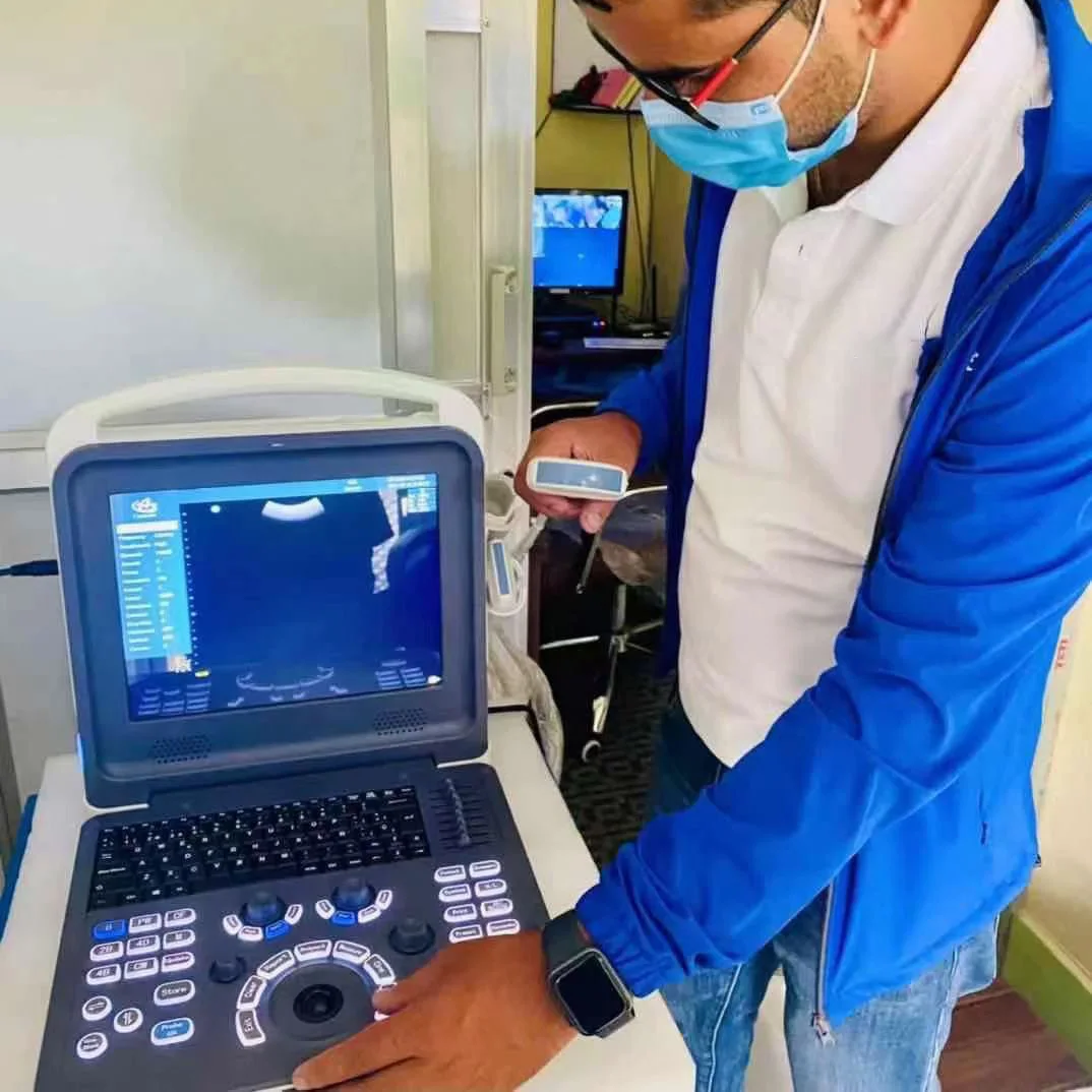 HUC-260 Hand-carried Fibroscan Machine Portable Color Dopler Diagnostic Ultrasound Scanner