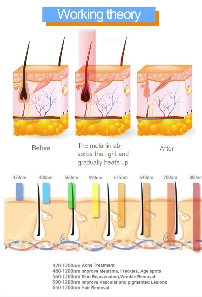 Ipl Hair Removal Machine Professional Ipl Hair Removal  Ipl Laser Pigmentation Manufacturing manufacture