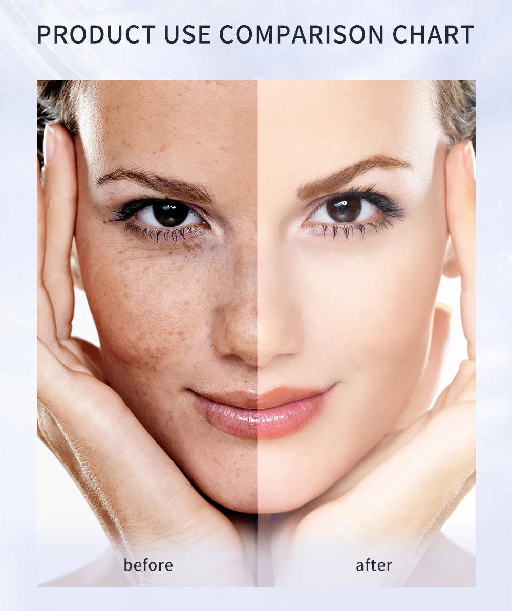 Private Label Wholesale Cosmetics Natural Skin Lightener Beauty