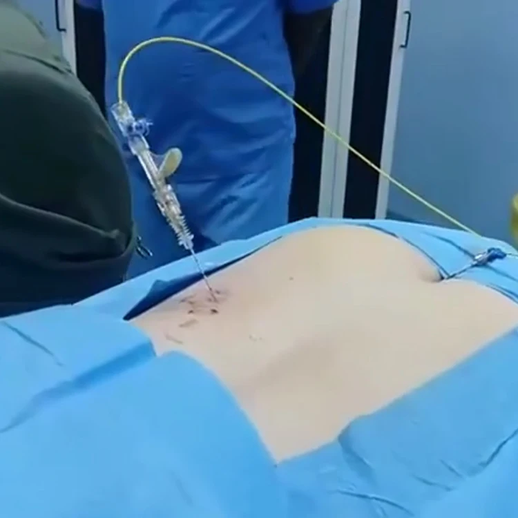 PLDD Percutaneous Laser Disc Decompression Diode Laser Machine 980nm+1470nm Spinal Decompression Therapy Machine