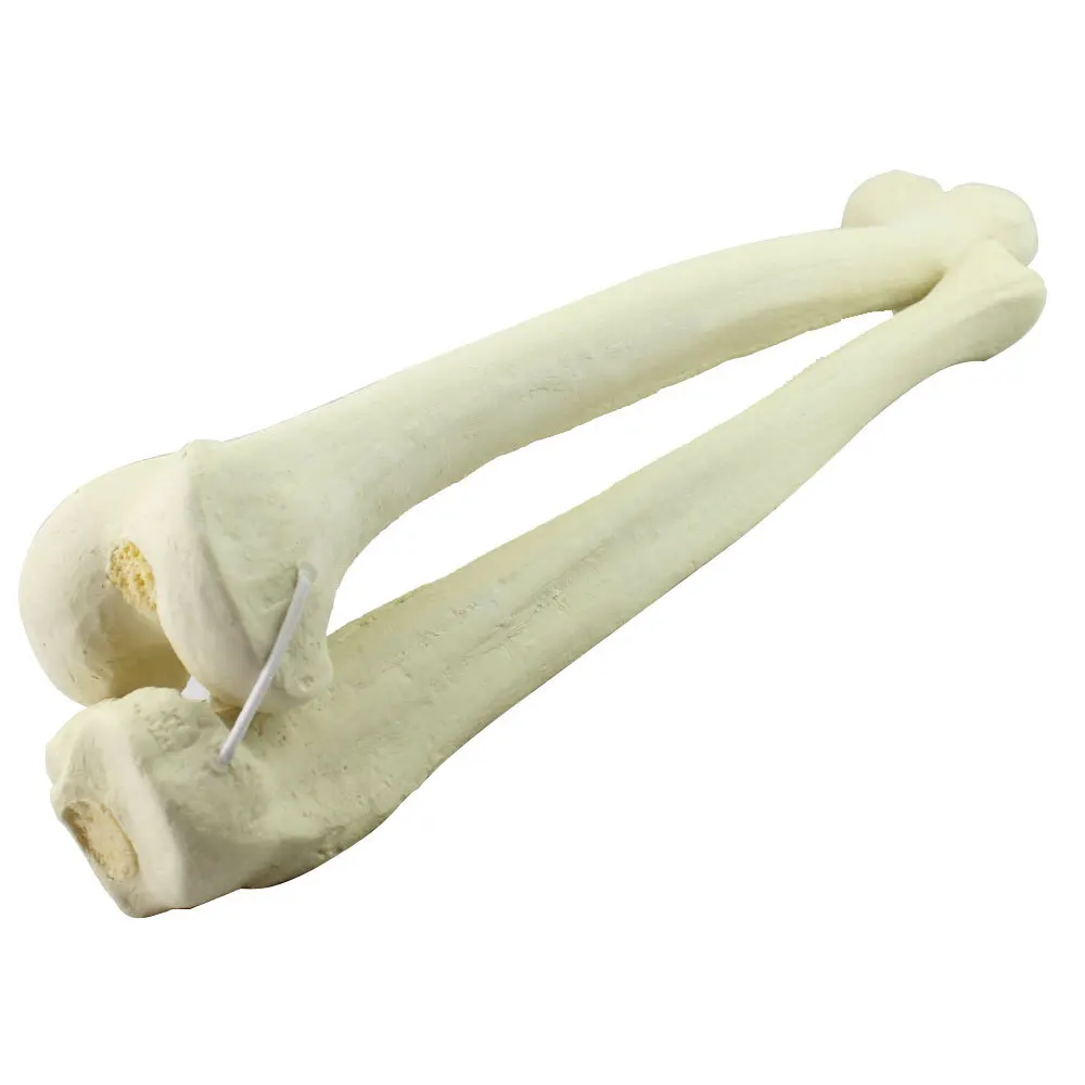 Human Tibia And Fibula Bone Model For Medical Learning And Training ...