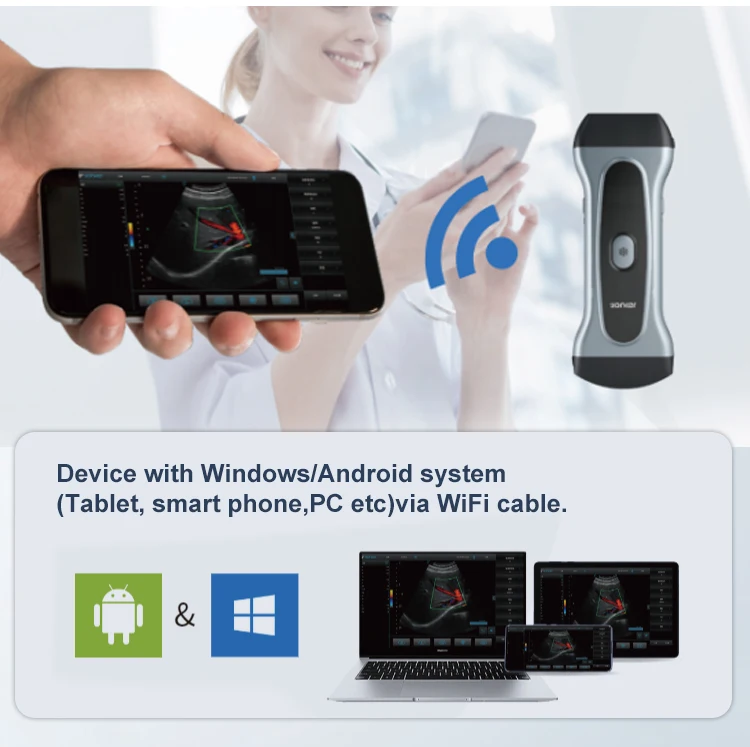 Picture of Yonker Pocket Veterinary Ultrasound Scanner - Portable & Wifi