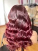 photo1