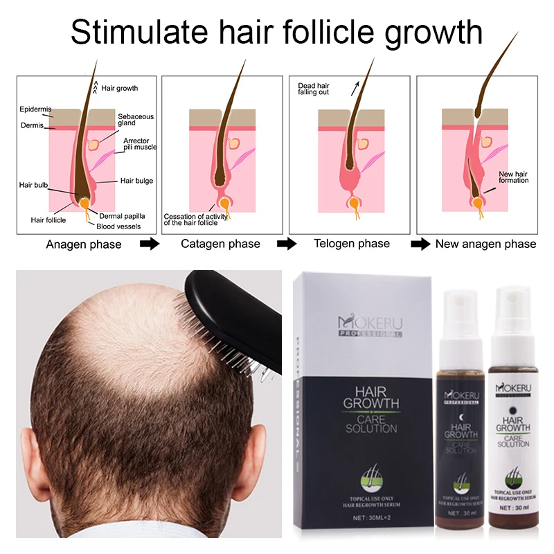 Huile Essence Pour Croissance Rapide Des Cheveux - Anti-chute - 10ML - Neuf