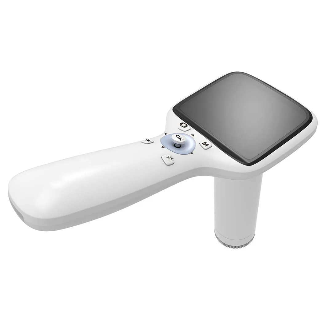 Big Discount Ophthalmic Diagnosis Portable Handheld Non-mydriatic Digital Fundus Retinal Camera factory