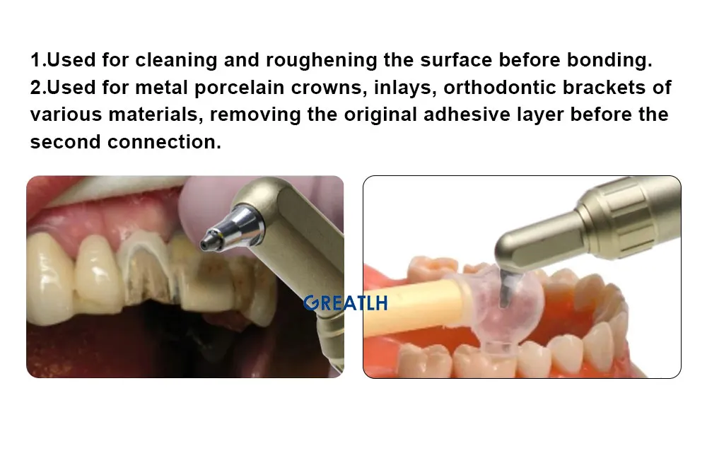 Dental Supplies Aluminium Oxide Dental Air Abrasion Water Dental Air