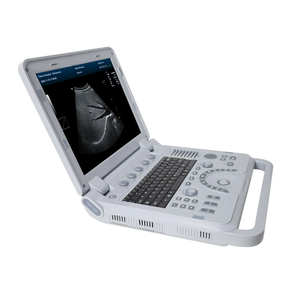 CONTEC CMS1700B-VET Veterinary Instruments for Pregnancy test Detector Portable Ultrasound Scanner V16