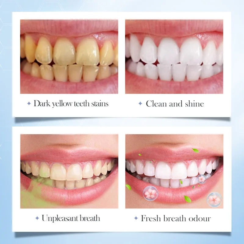 Высококачественная отбеливающая зубная паста для ухода за полостью рта