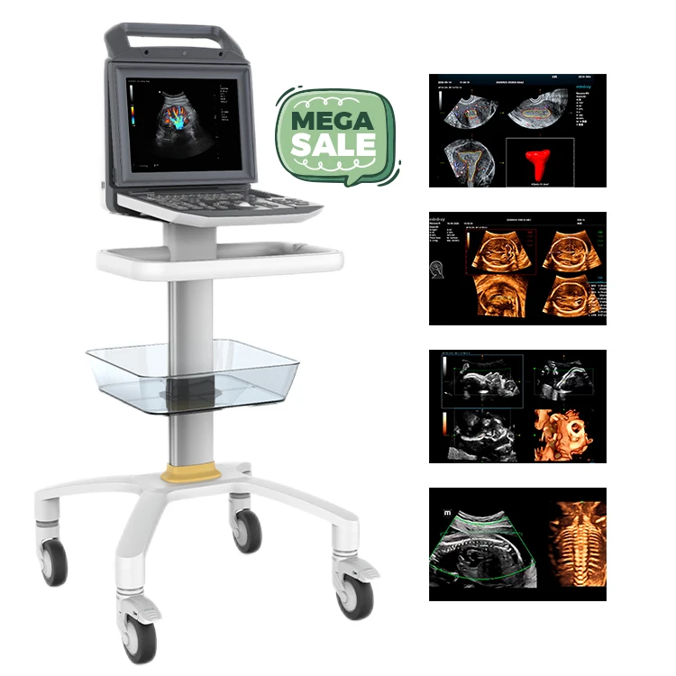 Full Digital Color Doppler Ultrasonic Diagnostic System Portable 4D  Pregnancy Ultrasound Scan Machine