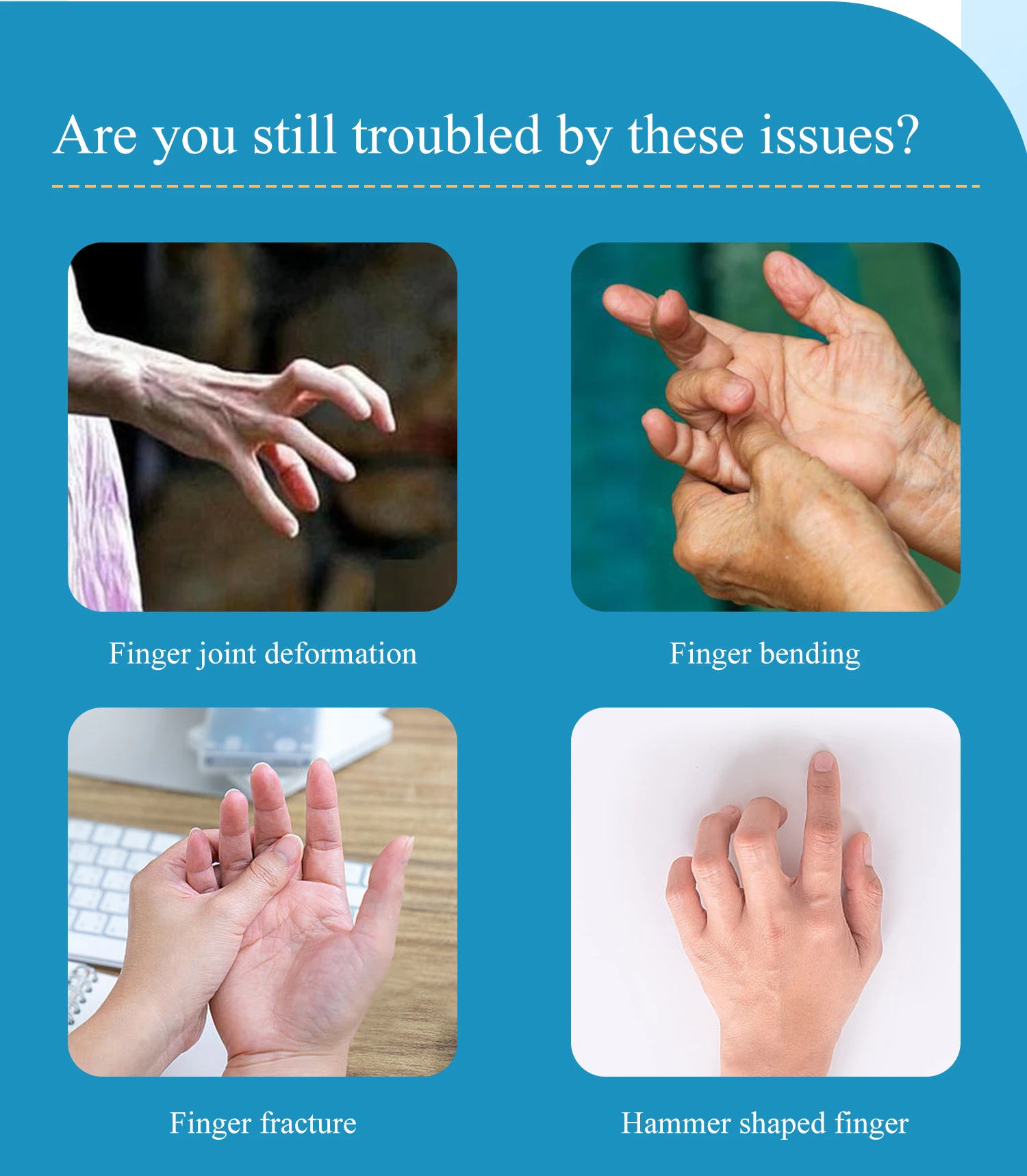Factory Price Finger Fixation Splint Suitable for External Fixation or ...