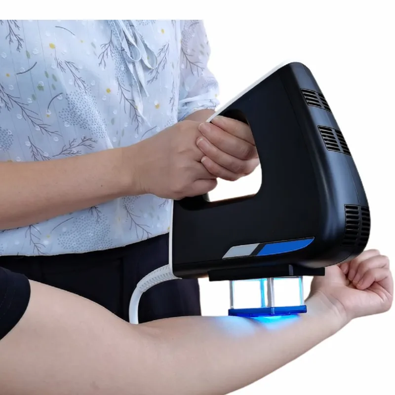 Kernel 308nm Excimer Laser - Efficient Vitiligo Treatment