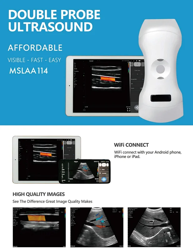 Wireless Double Ultrasound Probe MSLAA114