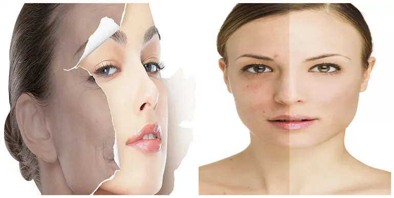 Hydrating ingredients pure allantoin CAS 97-59-6 Allantoin for makeup care