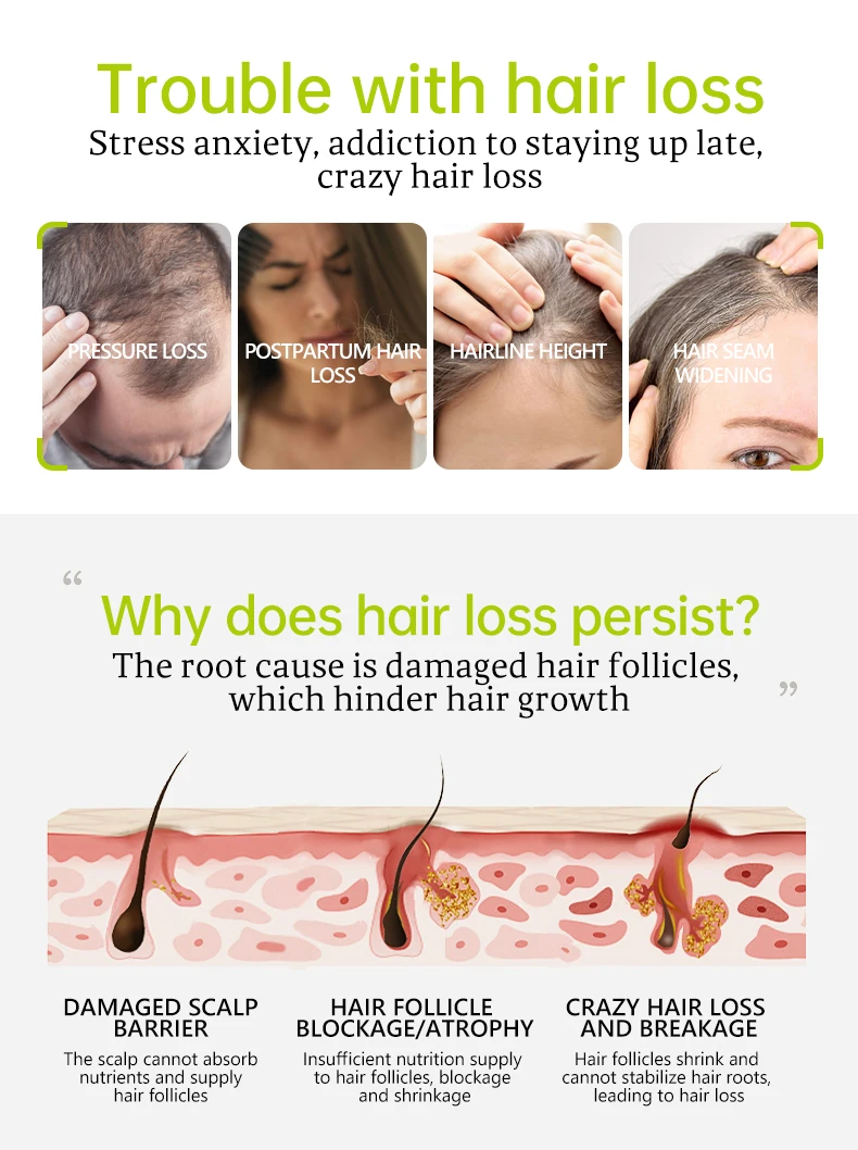 Disaar 3 pasos revitalización Anti pérdida de cabello planta natural cuidado del cabello Ginseng aceite de argán crecimiento del cabello champú jabón