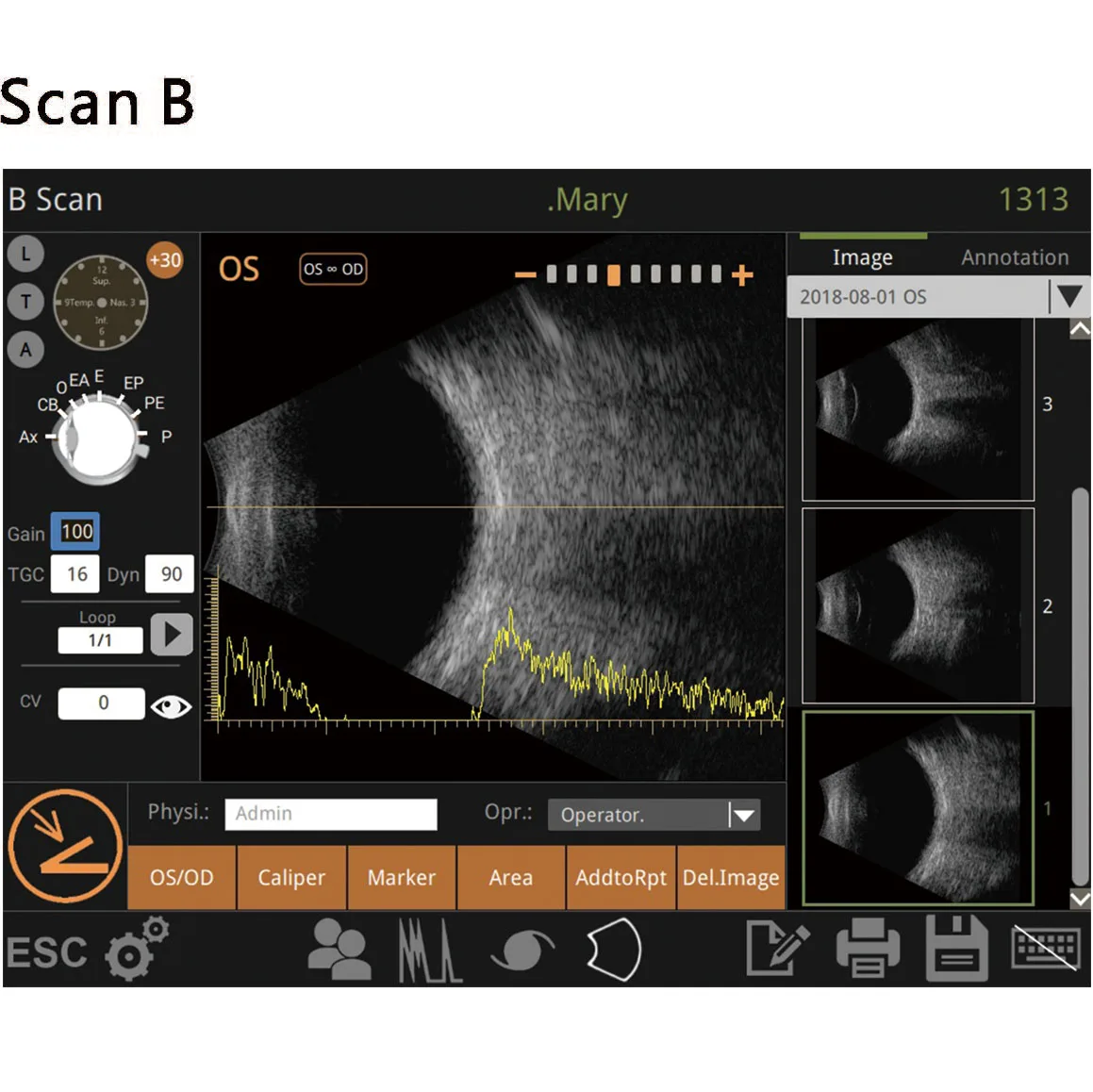Hot Sale Hospital Medical Laptop Handheld Full Digital Portable Ophthalmic A/B Ultrasound Scanner