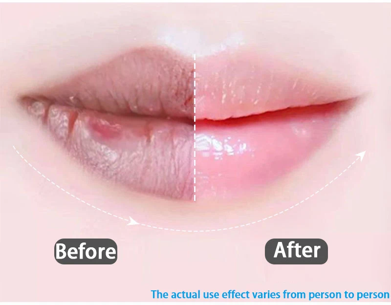 Baolun Reusable Custom Ice Packs Lips With Glitter Medical Lip Shaped ...