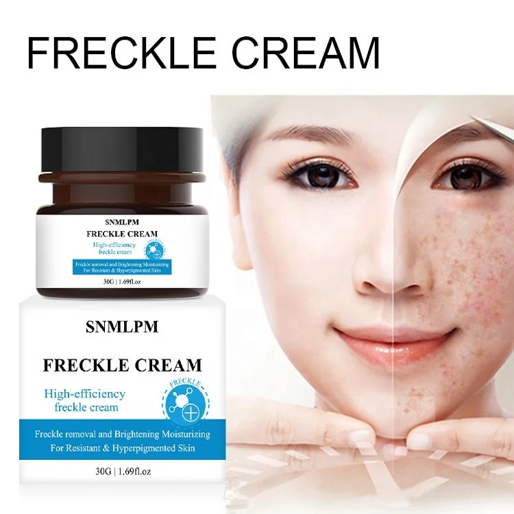 SNMLPM Freckle Removing Cream  30ml Private Label Face Whitening Cream Fade Dark Spot Freckle Face Cream