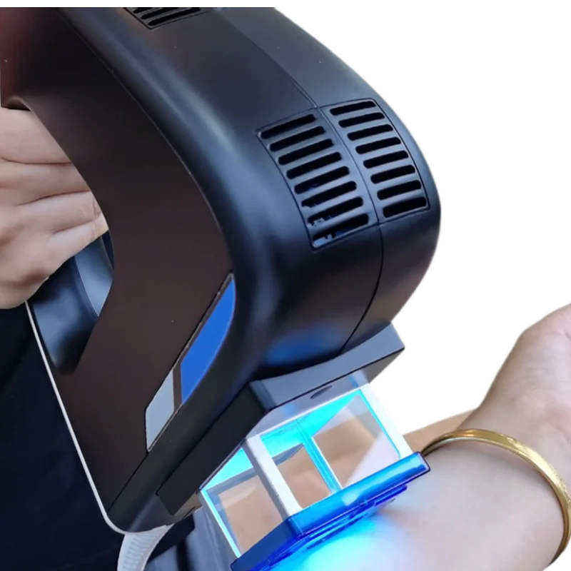 Kernel 308nm Excimer Laser - Efficient Vitiligo Treatment