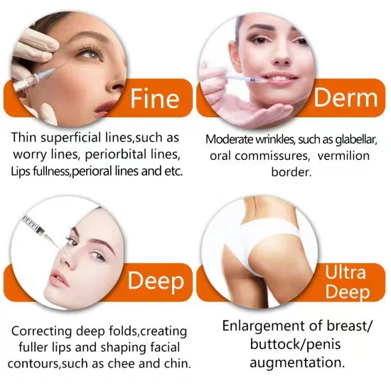 Long last facial dermal lip filler injection hyaluronic acid breast and hip augmentation filler,buttock injection