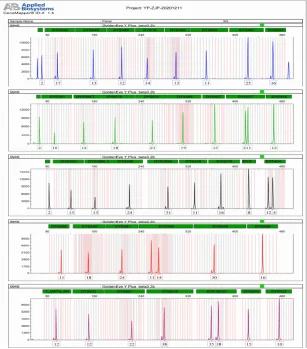 Whole Genome Analysis Dna Identification System Y Plus ( Non-extraction ...