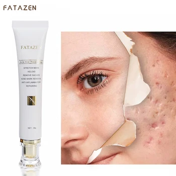 Customize Logo 30g Women Face Body Care Scar Repair Cream Acne Treatment Firming Fast Effective Scar Removal Cream