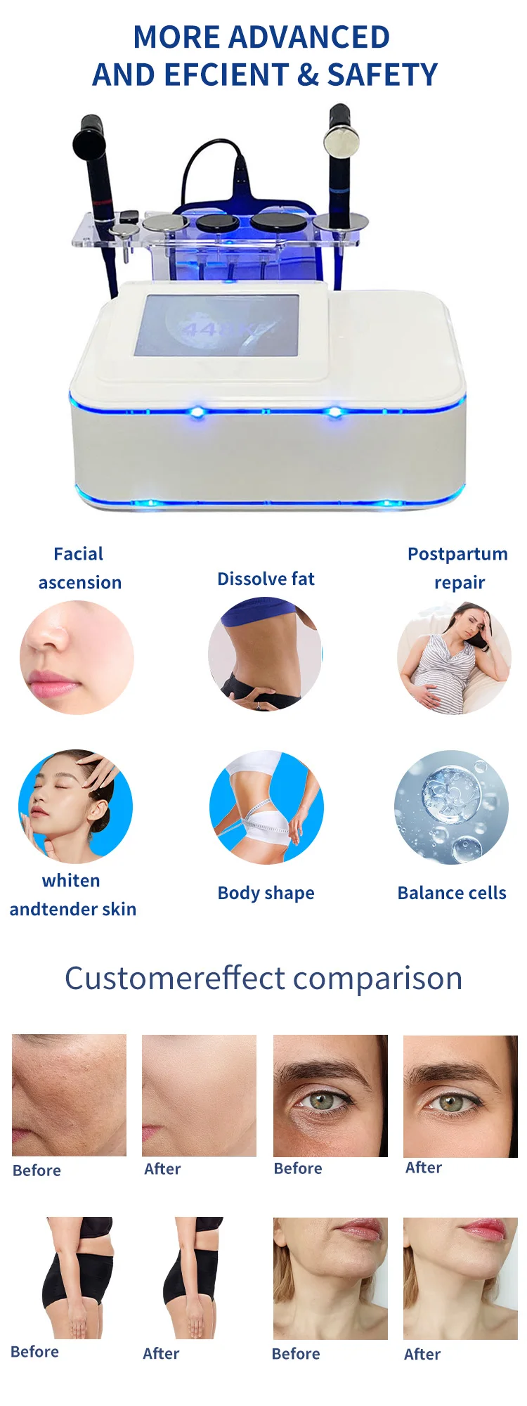 2 IN 1 Factory Price Radio Frequency Machine Portable Indiba For Fiziotherapy Rf Body Slimming Machine