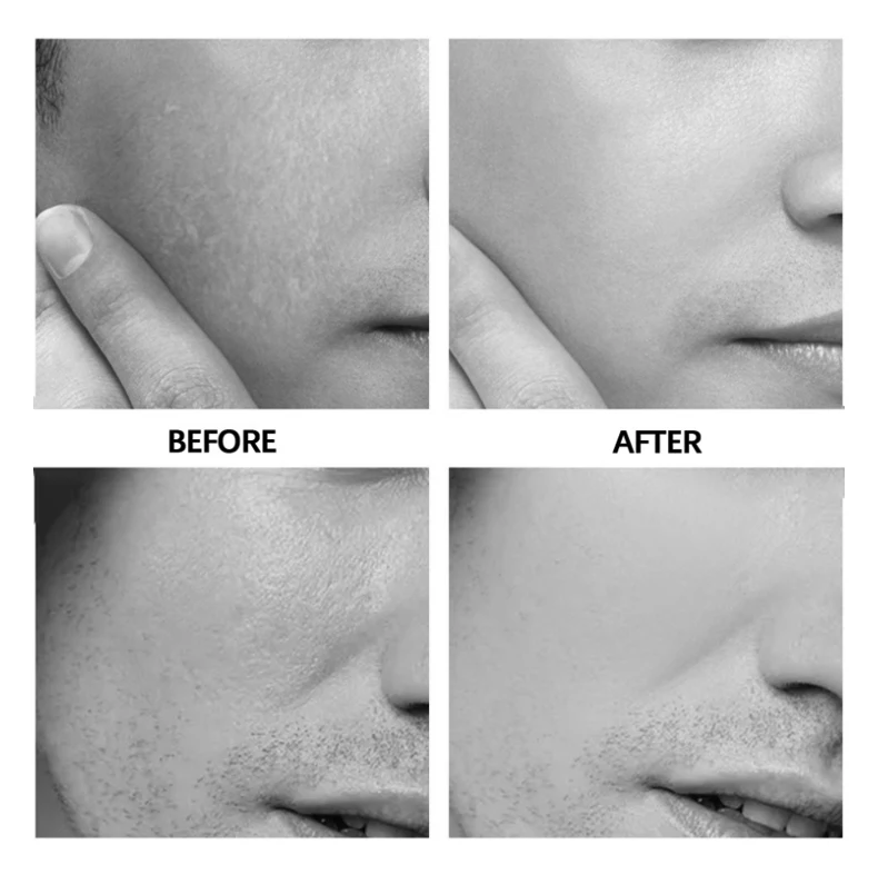 Source Factory Male Face Skin Nourishing Moisturizing and Whitening Night Cream Remove Black Spot for Men Man Japanese Formula