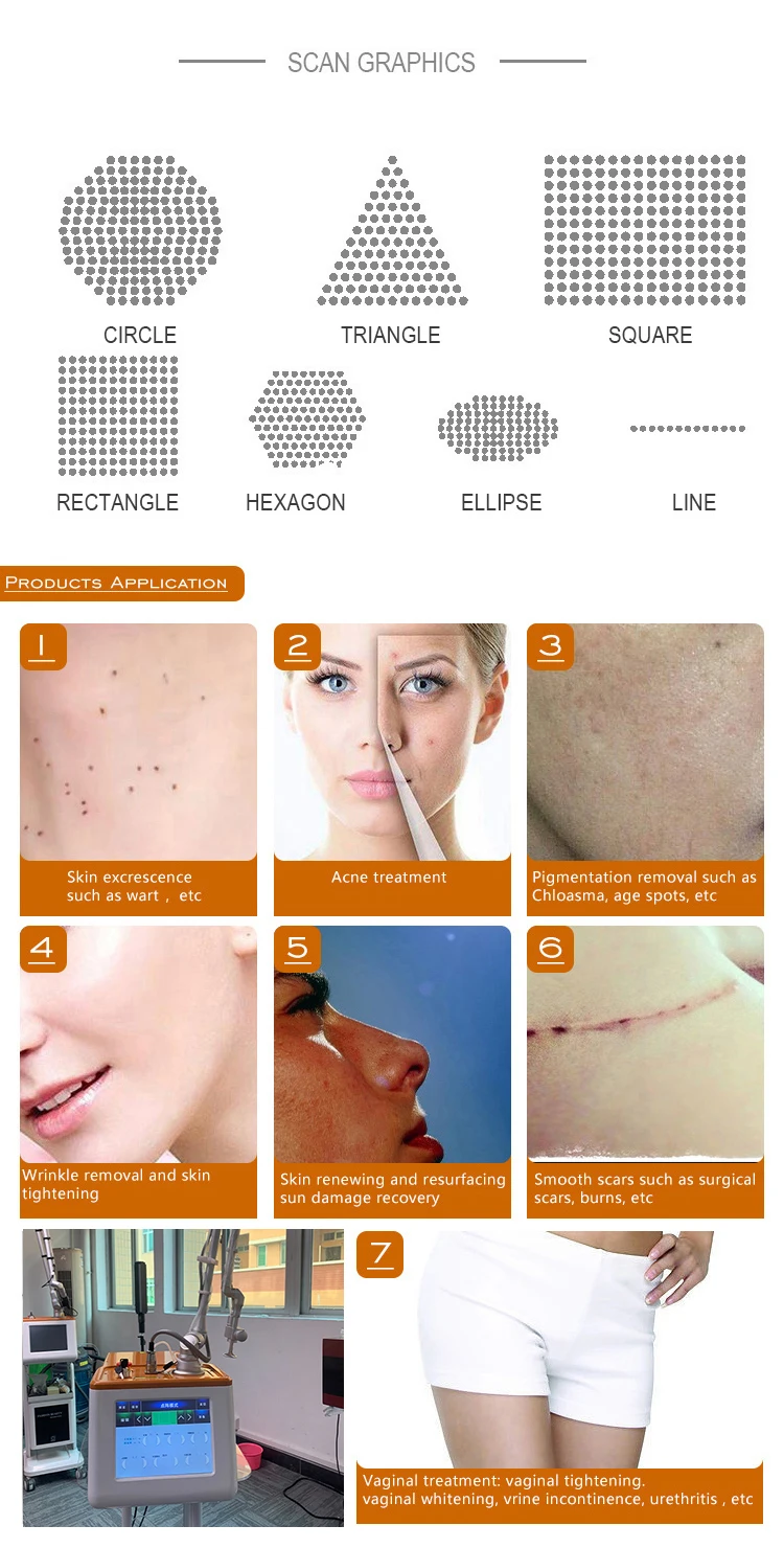 Запечатанное лазерное устройство, имитируемое с помощью лазерной машины с постоянным током CO2 - расстояние 0,1-2,6 мм 4