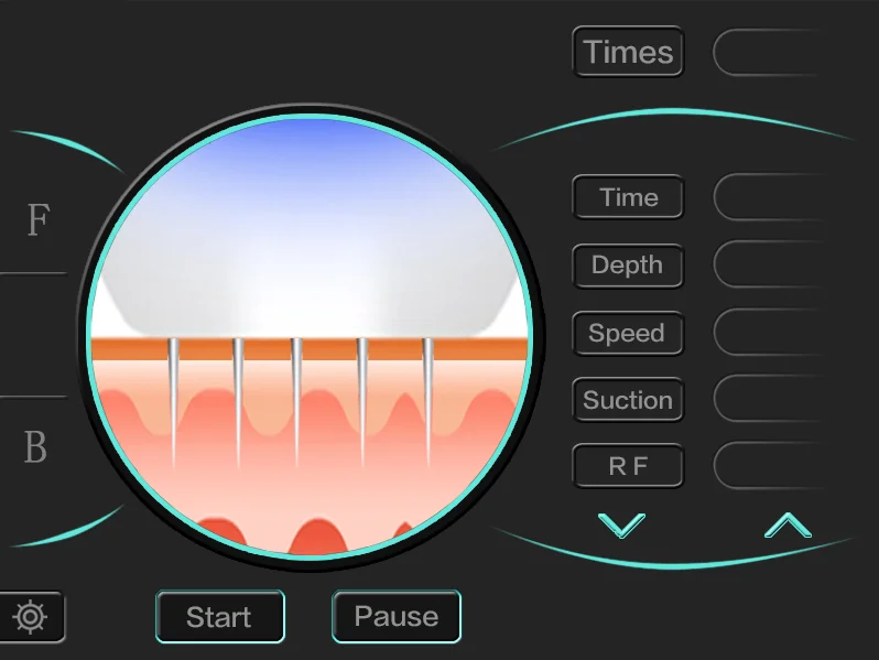 Facial Radio frequency vacuum rf Skin Tightening Rf Microneedling Machine