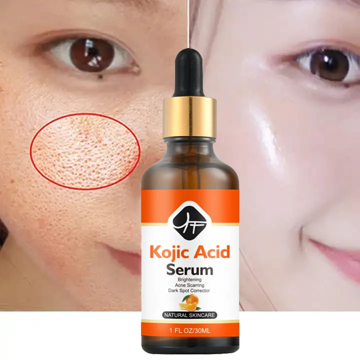 glutathione and kojic acid serum Private Label Vitamin C Kojic Acid Skincare Glutathione Serum Skin  Whitening Facial Serum for Dark Spots Remover Liquid Face