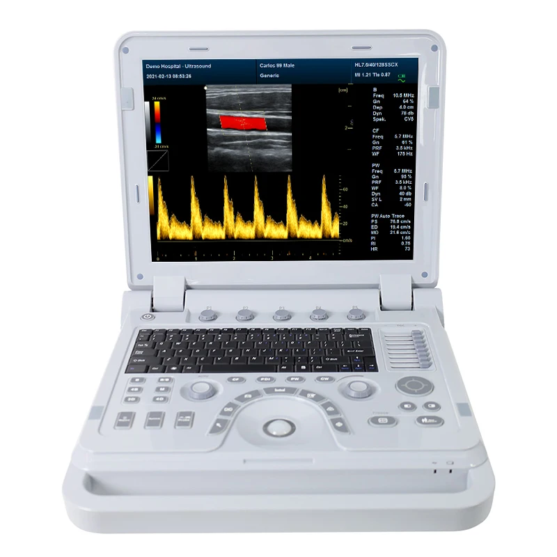 CONTEC CMS1700B Doppler Ultrasonic Phased Array Flaw Detector Heart Doppler Wifi Ultrasound Probe