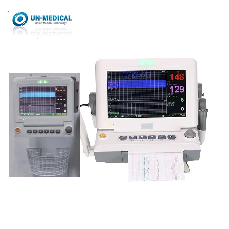Ультразвуковой фетальный монитор, профессиональный детектор сердечного ритма для беременных с принтом
