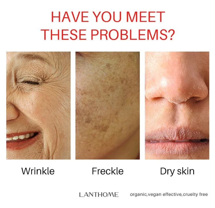 Korean Watermelon Sleeping Face Mask Repair Skin Care Products Anti