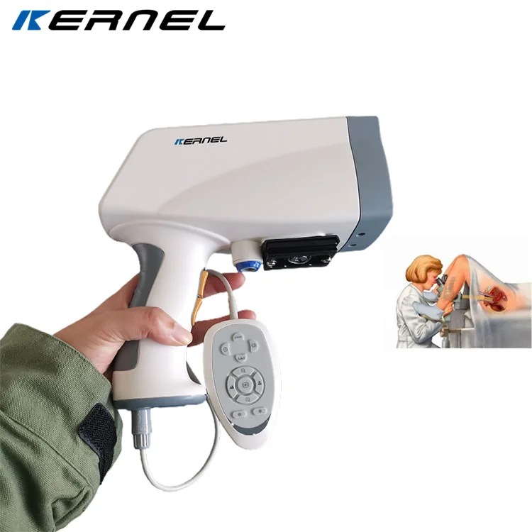 CE Cleared Digital Video Colposcope with Powerful Software Medical Mobile HD Digital Video Colposcope for Gynecology KN-2200