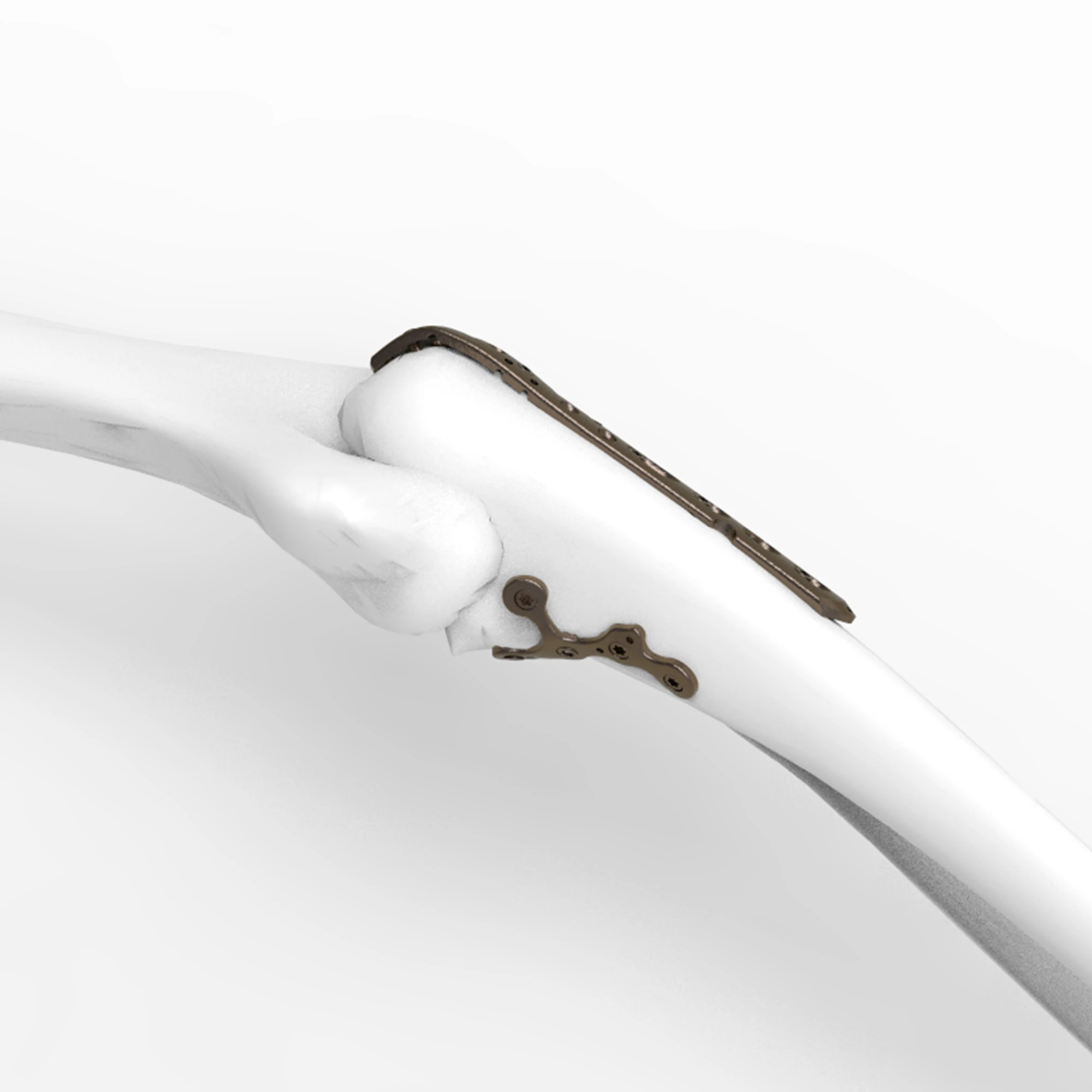 Product View 1