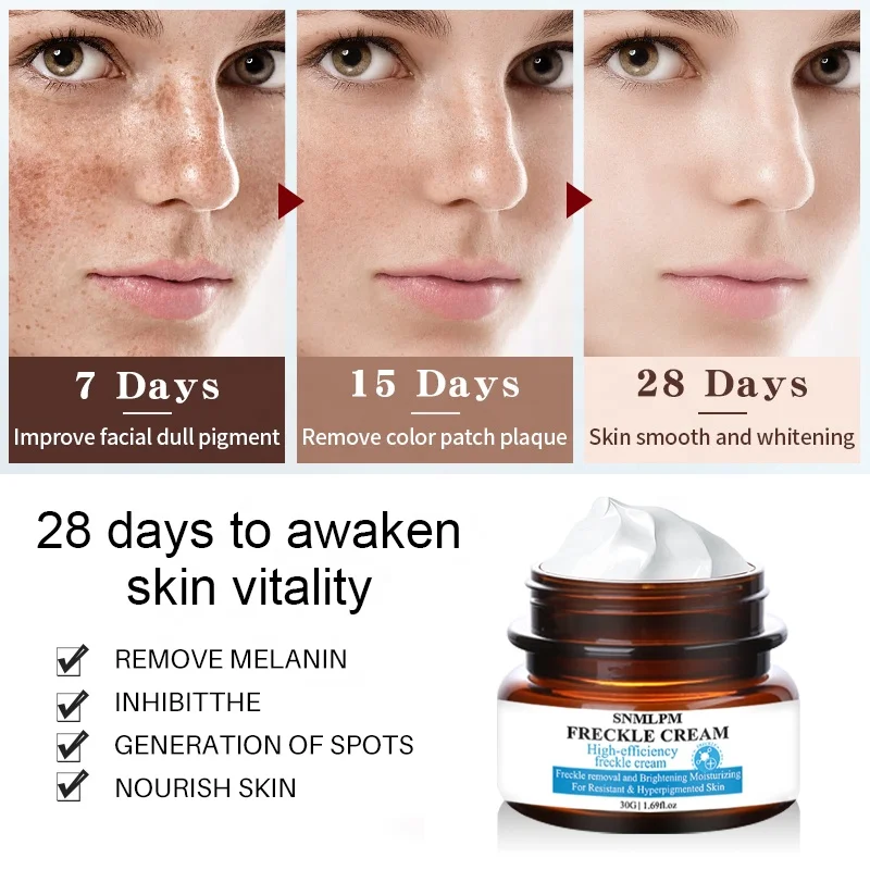 SNMLPM 30g Freckle Cream Deep Moisturizing Melanin Freckle Cream Dark Spots Acne Scar Face Whitening Cream