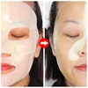 Niacinamide