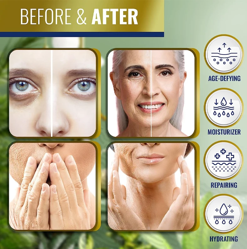 Skin Whitening Body Lotion Cream With Retinol And Hydraulic Acid Large