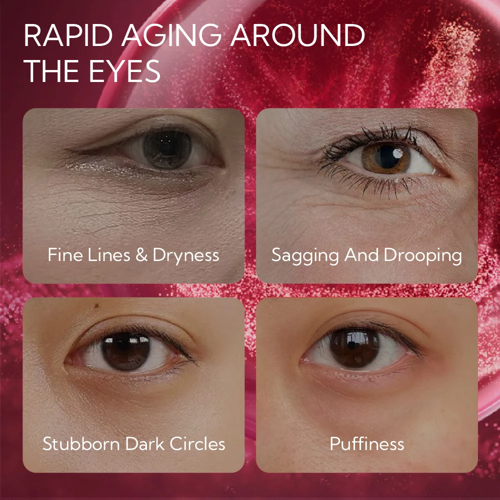 LANBENA Hot Selling Firming Dark Circles Hydrogel Gel Collagen Eye Patch Mask Pads manufacture